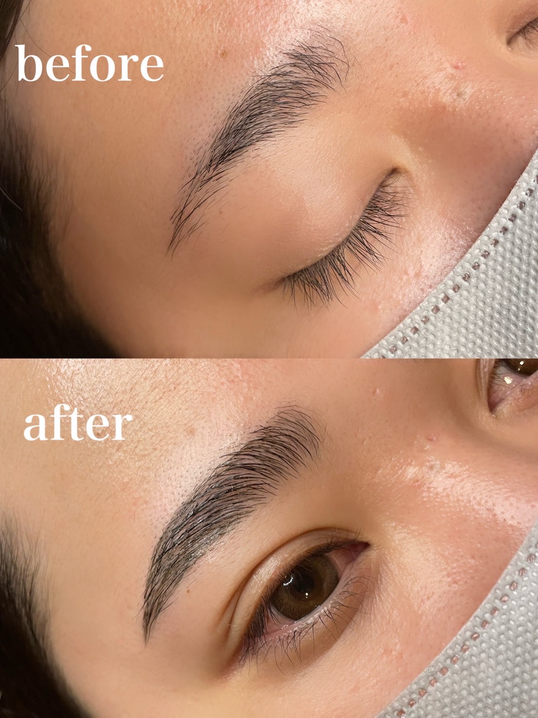 HOLLYWOOD BROW LIFT PREVIS メンズ脱毛サロン